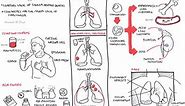 Lung Cancer - Overview