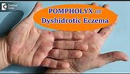 DYSHIDROTIC ECZEMA OR POMPHOLYX: Causes,Symptoms, & Treatment - Dr. Aruna Prasad | Doctors' Circle