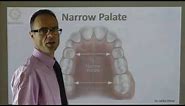 A Narrow Palate By Dr Mike Mew