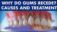 Gum recession - Treatment of gingival retraction ©