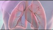 Symptoms of lung cancer