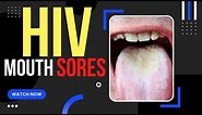 When Do Hiv Mouth Sores Appear ?