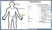Pathology 038 a Metaplasia types Cell adaptation atrophy hypertrophy hyperplasia squamous columnar