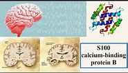 S100 calcium binding protein B