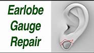 Earlobe Gauge Repair, Both Small and Large Sizes