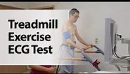 Treadmill Exercise ECG Test