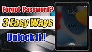 Forgot Your iPad Password? We’ve Got 3 Easy Ways for You to Unlock It!