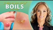 Boils | 9 Tips to Get Rid of Boils Naturally | Dr. J9 Live