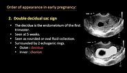 Ultrasound of normal early pregnancy