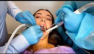 Injection Dental Drilling Extraction on Beautiful Girl