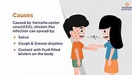 Chicken Pox: Symptoms, Causes, Prevention and Treatment | Yashoda Hospitals