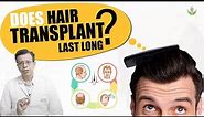 How Long Does Hair Transplant Last? | Care Well Medical Centre