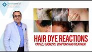 Hair dye reactions : Causes, Diagnosis, Symptoms and Treatment