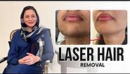 Facial Laser Hair Removal - All FAQs Answered!