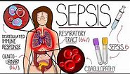 Understanding Sepsis (Sepsis Explained Clearly)