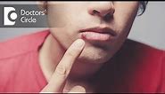 What is Herpes Labialis? - Dr. Aniruddha KB