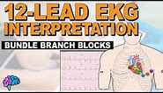 Bundle Branch Blocks MADE EASY!! - 12 Lead EKG