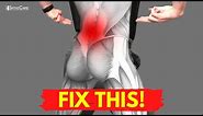 How to Fix Your Lower Back Pain for Good