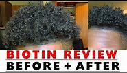 BIOTIN Hair Growth Results Before and After