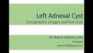 Sonographic view of Adnexal Cyst II Images & live scan II Dr. Nasrin Fatema
