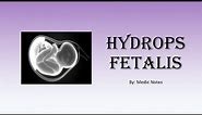 Hydrops fetalis - causes, investigation, management, prognosis