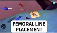 Central Line placement (Femoral Vein): Medical animation
