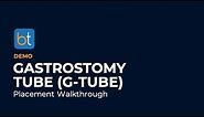 Gastrostomy Tube Placement (G-Tube) by Interventional Radiology | BackTable Demo