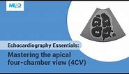 Echocardiography Essentials: Mastering the apical four-chamber view (4CV)