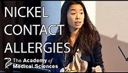Causes of nickel skin allergies | Dr Teresa Tsakok