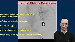 Choroid Plexsus Papilloma