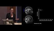 Autism: A view from neuroscience - A CCN public lecture