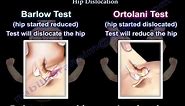 Barlow & Ortolani test, Congenital Hip Dislocation- Everything You Need To Know - Dr. Nabil Ebraheim