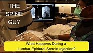 What Happens During a Lumbar Epidural Steroid Injection?
