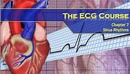 The ECG Course - Sinus Rhythms