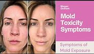 Mold Toxicity Symptoms| The Symptoms of Mold Exposure