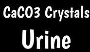 Calcium Carbonate Crystals In Urine | Types Of Crystals In Urine | Microscopic Urine Examination |