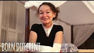 The Teenager With Butterfly Skin | BORN DIFFERENT