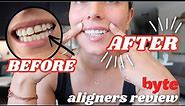 BYTE ALIGNERS REVIEW | progress + byte aligners before & after