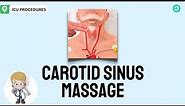 Carotid Sinus Massage: What is it and How to perform the procedure?