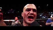 BLOODIEST MMA FIGHT OF ALL TIME RORY MCDONALD VS ROBBIE LAWLER 2