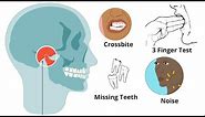 Is Your Jaw UNBALANCED - Uneven Jaw: Causes, Treatments (MUST KNOW)