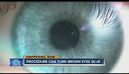 Procedure can turn brown eyes blue