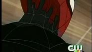 Spectacular Spider-Man - Turning into the Black Spiderman