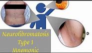 Neurofibromatosis Type 1 Mnemonic | Signs of NF1