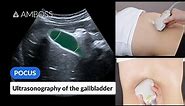 Point of Care Ultrasound of the Gallbladder - AMBOSS Video