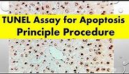 TUNEL Assay - Apoptosis | TUNEL Assay Principle Procedure | Biology Lectures