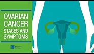 Understanding Ovarian Cancer Stages and Symptoms