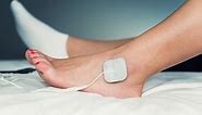 TENS Therapy for Foot Neuropathy: Step-by-Step Guide - Optimize Health 365