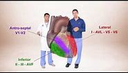 ECG for Beginners. ECG Diagnosis of ST Elevation Myocardial Infarction (STEMI)