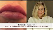 Lipstick Allergy - What I am allergic to and how to speed up healing